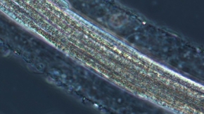 Ecophysiology of Thioploca ingrica as revealed by the complete genome sequence supplemented with proteomic evidence